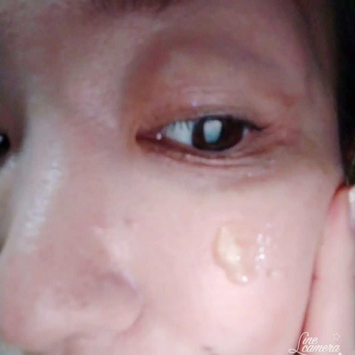 RJスキンケアソープ/アピセラピーコスメティクス/洗顔石鹸を使ったクチコミ(4枚目)