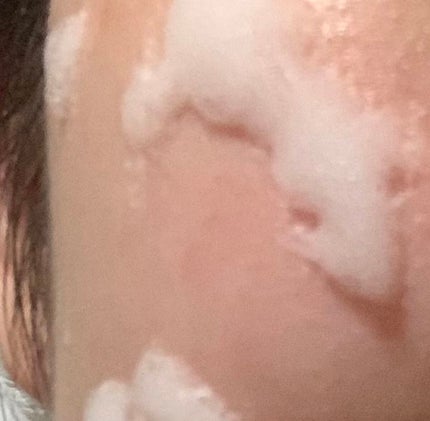 マジックバブルエッセンスパックMINI/BAKER7/シートマスク・パックを使ったクチコミ(2枚目)