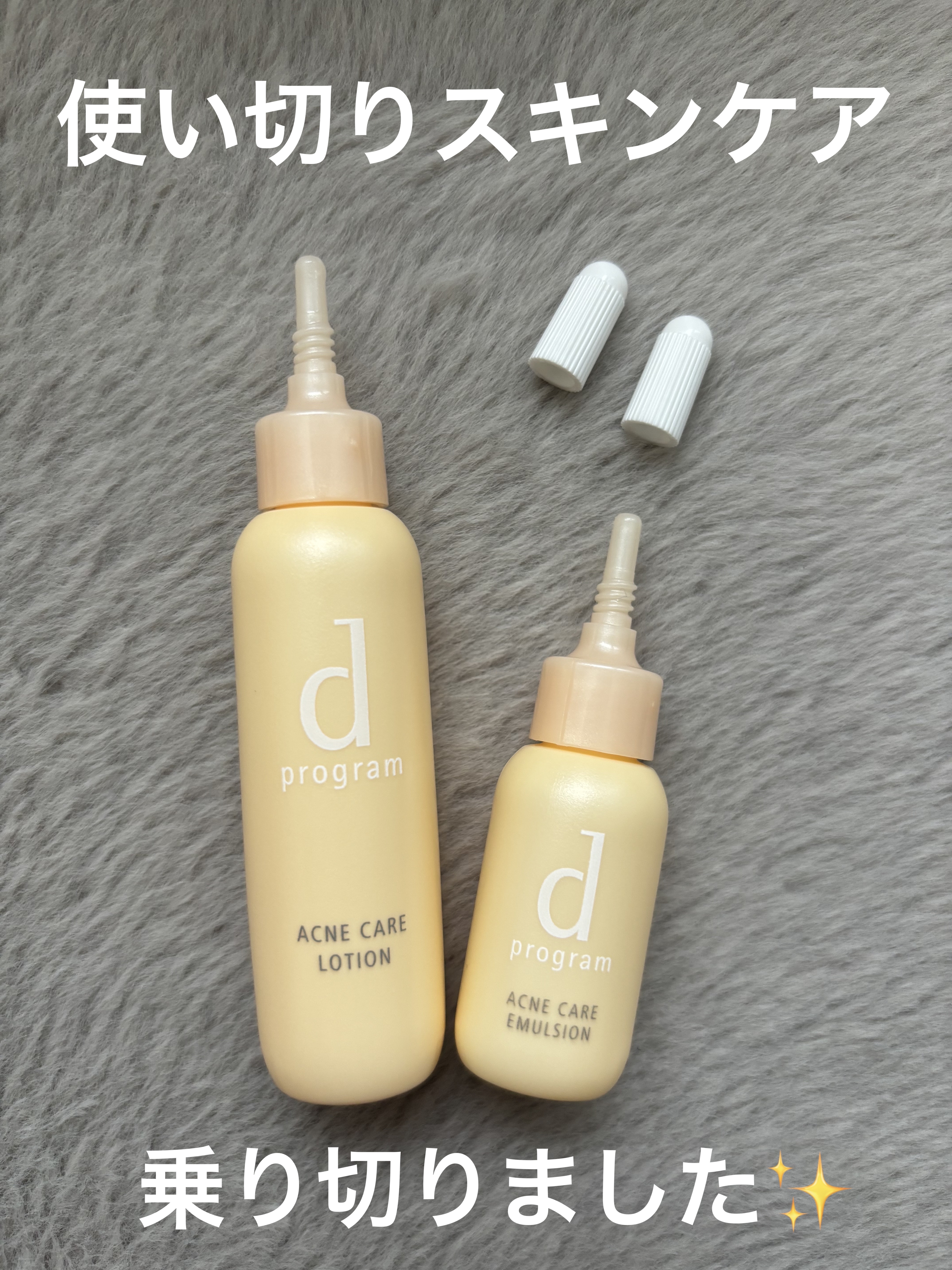 アクネケア セット MB/d プログラム/トライアルキットを使ったクチコミ（1枚目）