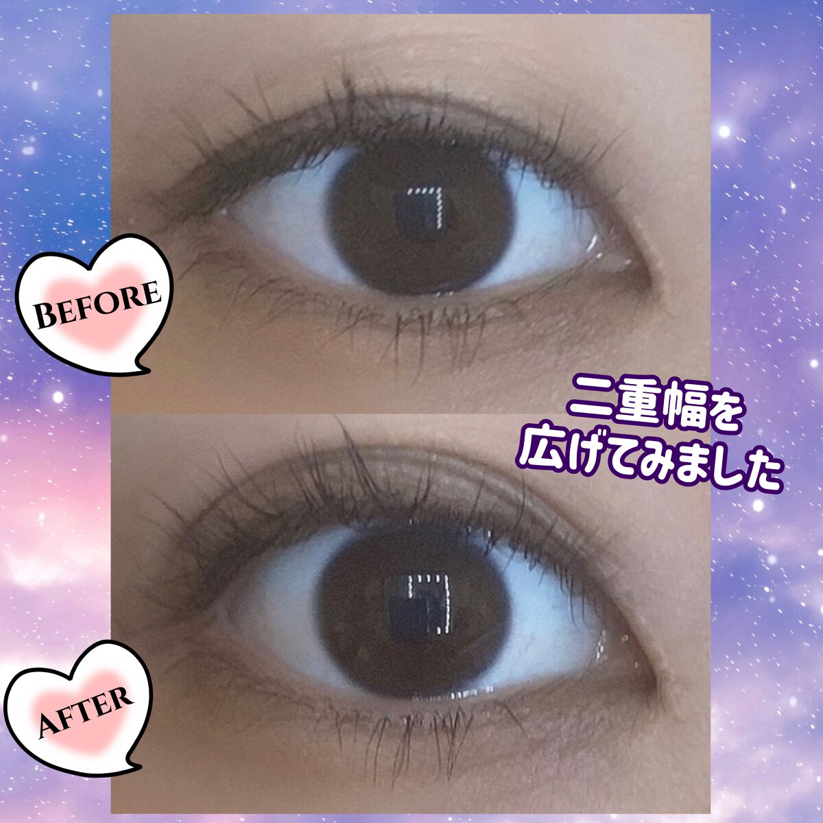 オリシキ アイリッドスキンフィルム		/D-UP/二重まぶた用アイテムを使ったクチコミ（3枚目）