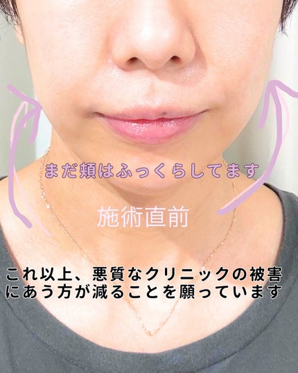 フラッフィーブラーティント/2aN/リップティントを使ったクチコミ(4枚目)