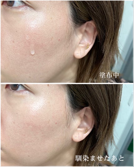 ナイアシンアミド 22% + 亜鉛 /opigen/美容液を使ったクチコミ(6枚目)