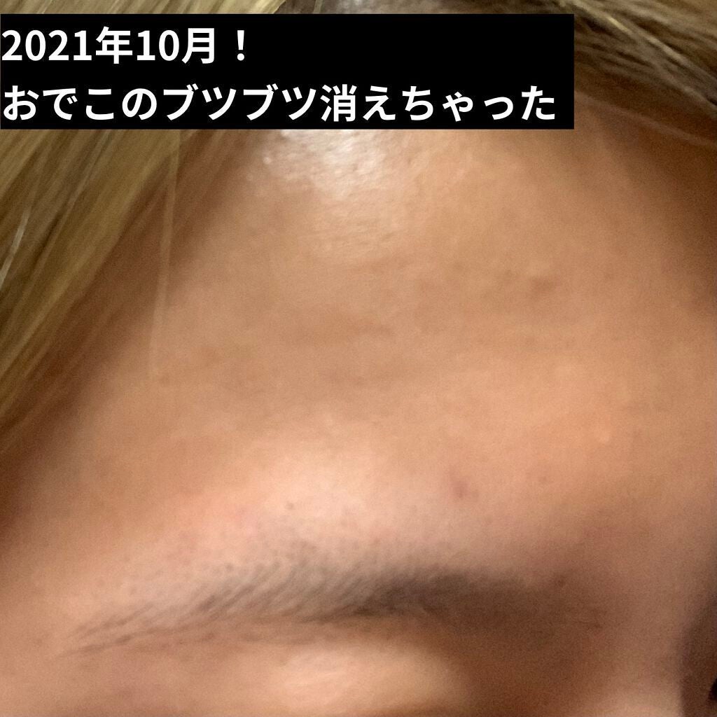 ハトムギ化粧水(ナチュリエ スキンコンディショナー R )/ナチュリエ/化粧水を使ったクチコミ(3枚目)