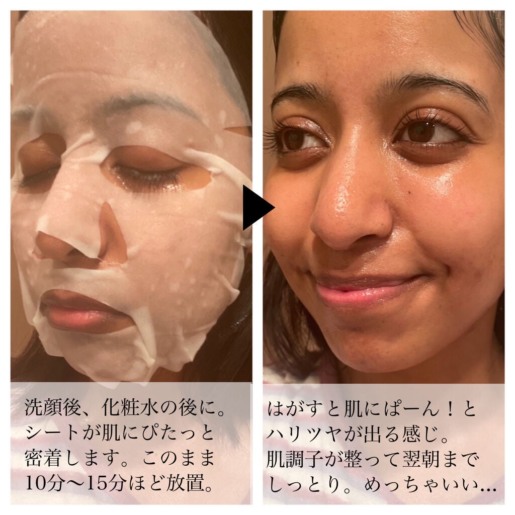 SUIKO HC シカバリアマスク/SUIKO HATSUCURE/シートマスク・パックを使ったクチコミ(4枚目)