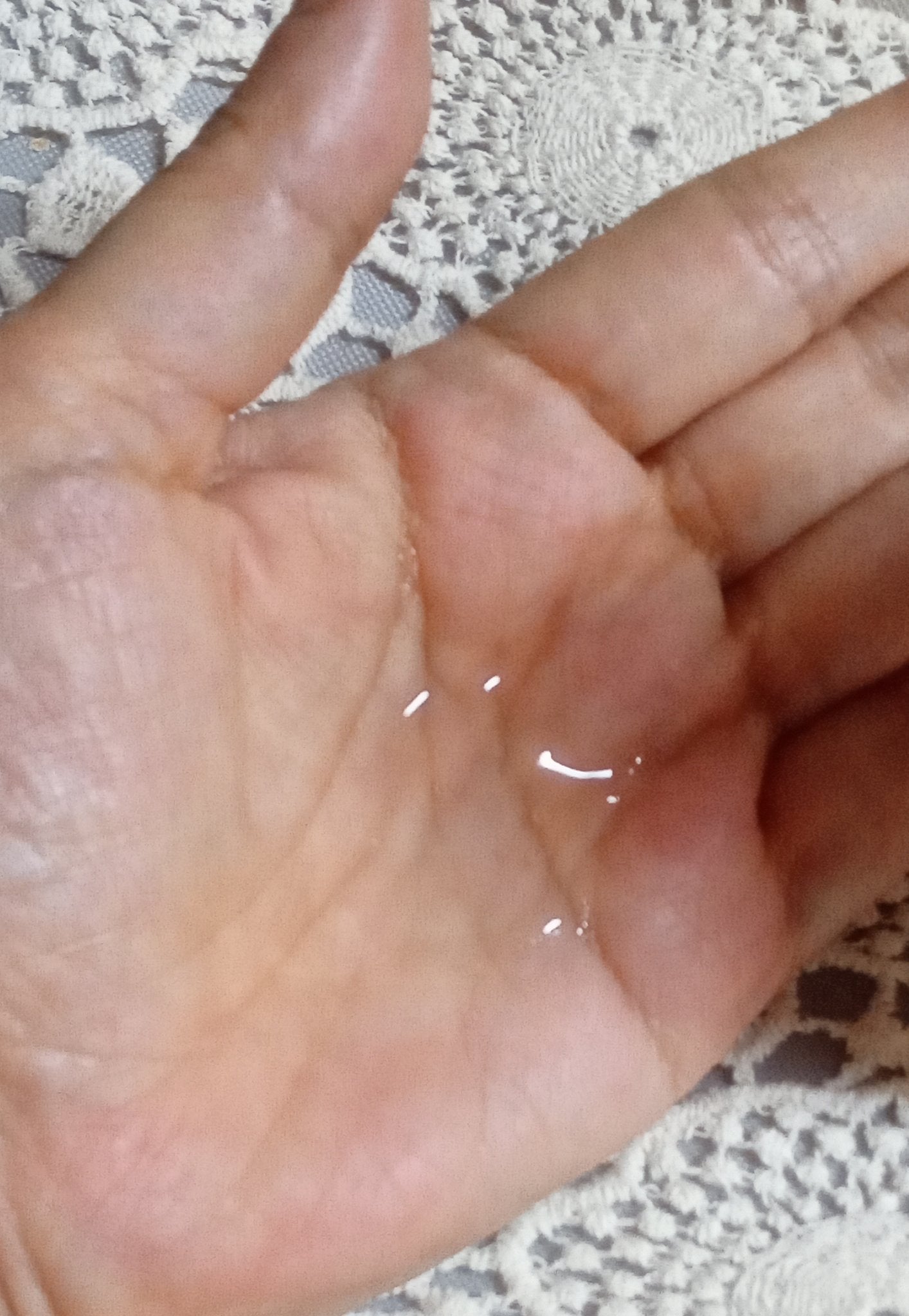 ヒト幹細胞培養エキス原液 LP/fracora/美容液を使ったクチコミ(5枚目)