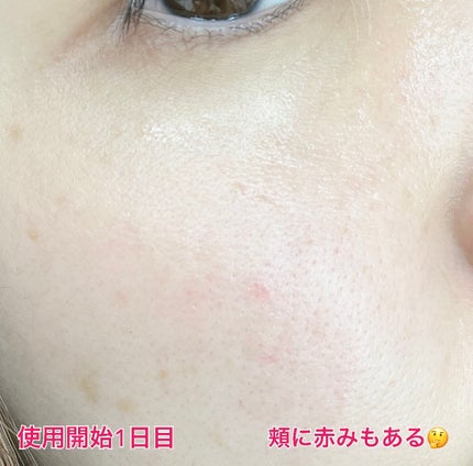 ヘデラヘリックス デイリー&クイック スージングマスク/Milk Touch/シートマスク・パックを使ったクチコミ(4枚目)