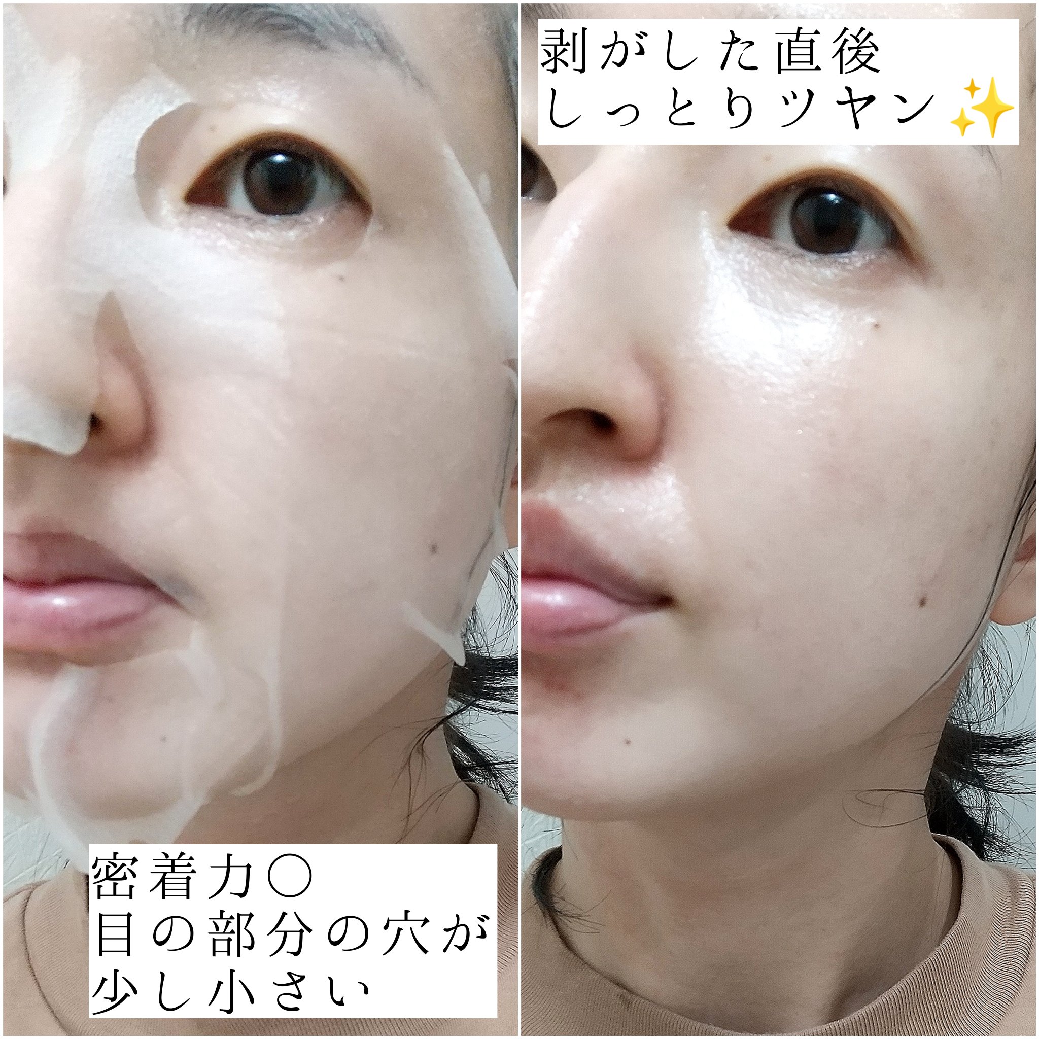 ダーマレーザースーパーVC100マスク/クオリティファースト/シートマスク・パックを使ったクチコミ（3枚目）