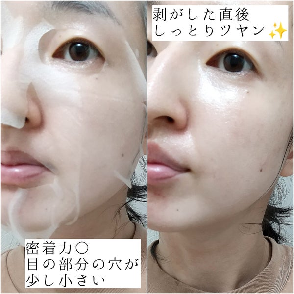 ダーマレーザースーパーVC100マスク/クオリティファースト/シートマスク・パック by はな🫧