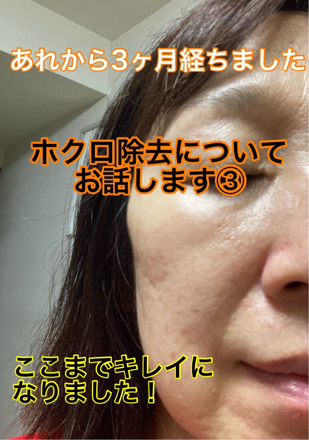 ネイチャーコンク 薬用クリアローション/ネイチャーコンク/拭き取り化粧水を使ったクチコミ（1枚目）