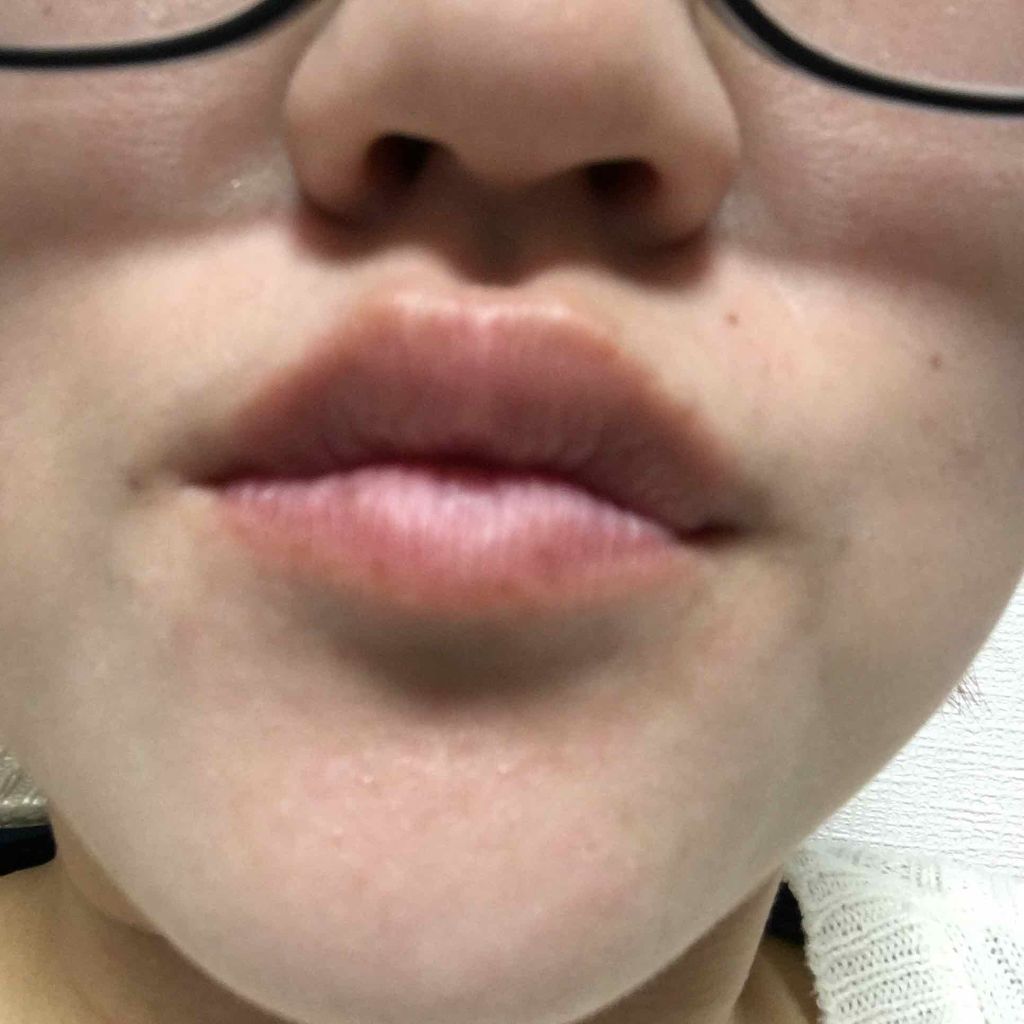 【旧】ディオール アディクト リップ グロウ/Dior/リップケアを使ったクチコミ(4枚目)