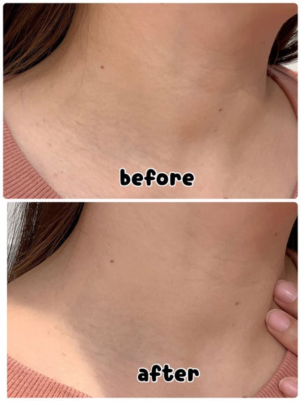 リンクルセラム/ASBELLE/フェイスクリームを使ったクチコミ(6枚目)