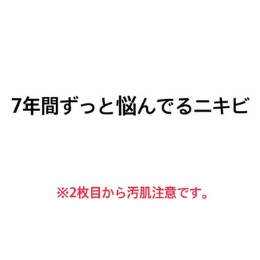 ※不快にさせてしまった方はすいません🙇‍♀️

今日は自分の肌について書きます。
是非、アドバイスお願いします！！

私は小学６年生の後半からずっとニキビに悩んできました。おそらく、脂性肌だと思っていま