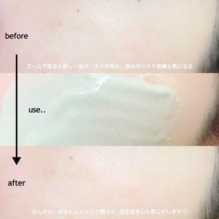 ドクダミ化粧水/ONE THING/化粧水を使ったクチコミ(3枚目)