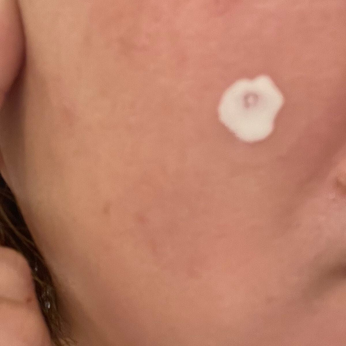 薬用ニキビケア スポッツクリーム/アクネスラボ/フェイスクリームを使ったクチコミ(3枚目)