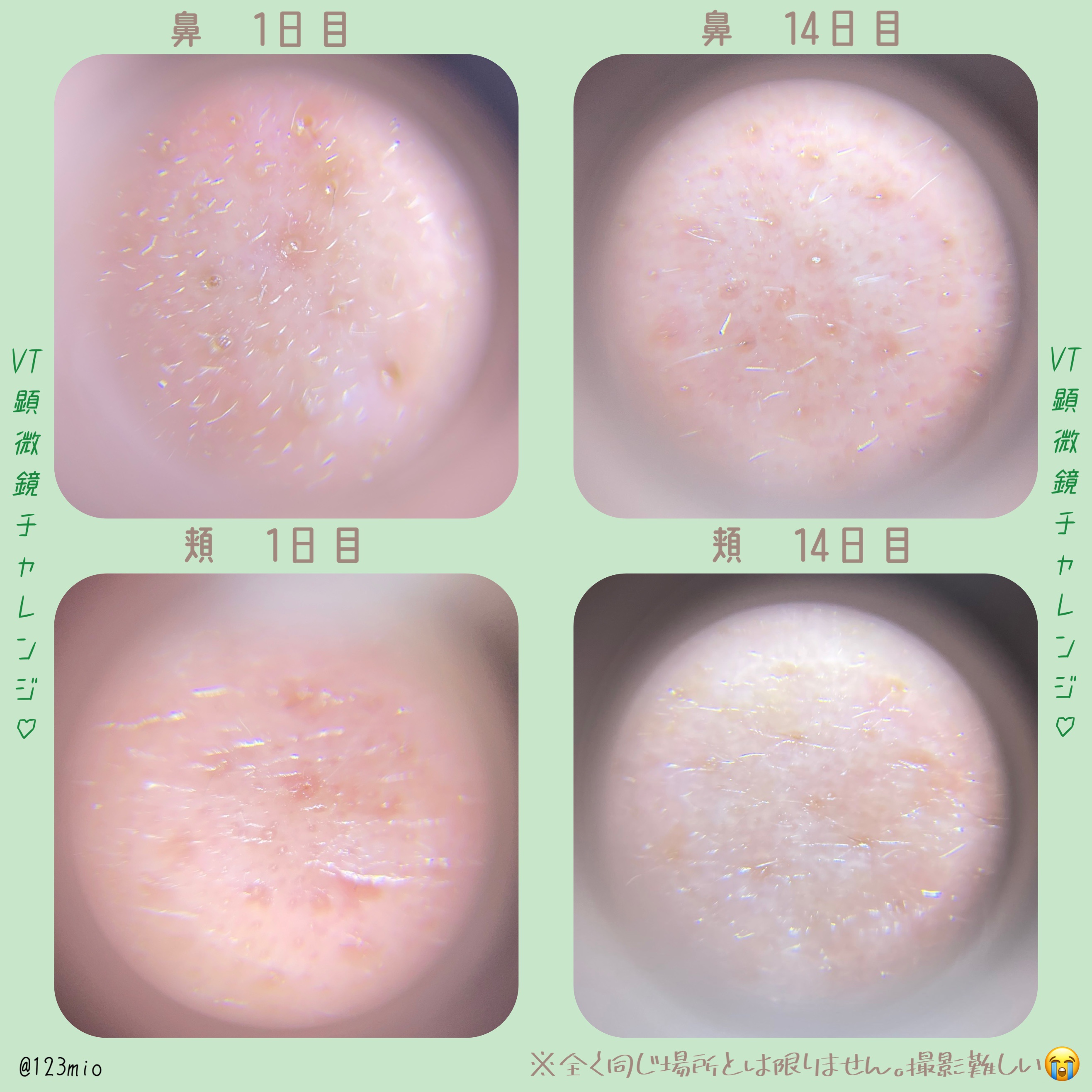 シカレチA エッセンス0.1/VT/美容液を使ったクチコミ（2枚目）