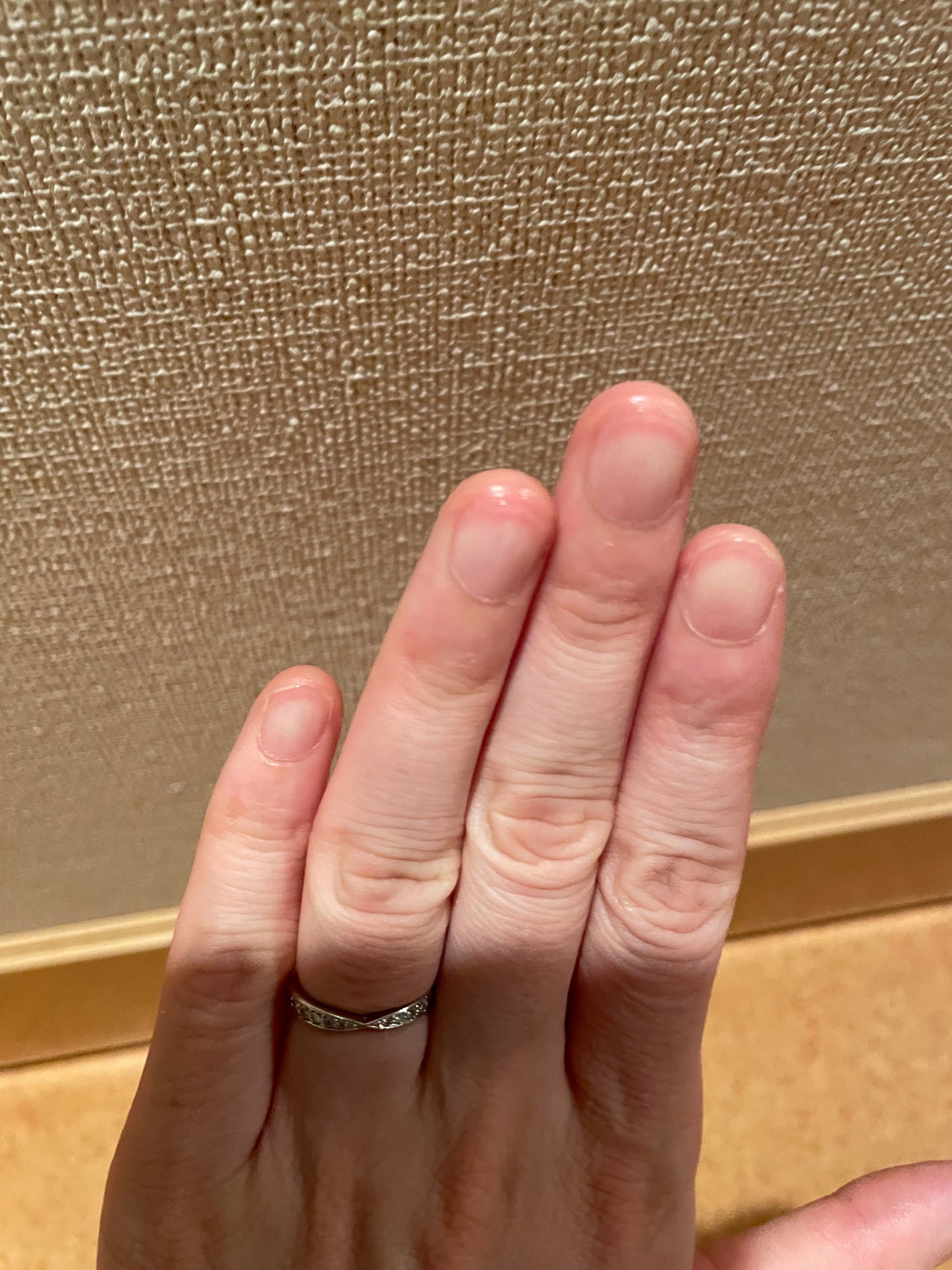 ブルーブライトネイルオイル/EMROSÉ/ネイルオイル・トリートメントを使ったクチコミ(3枚目)