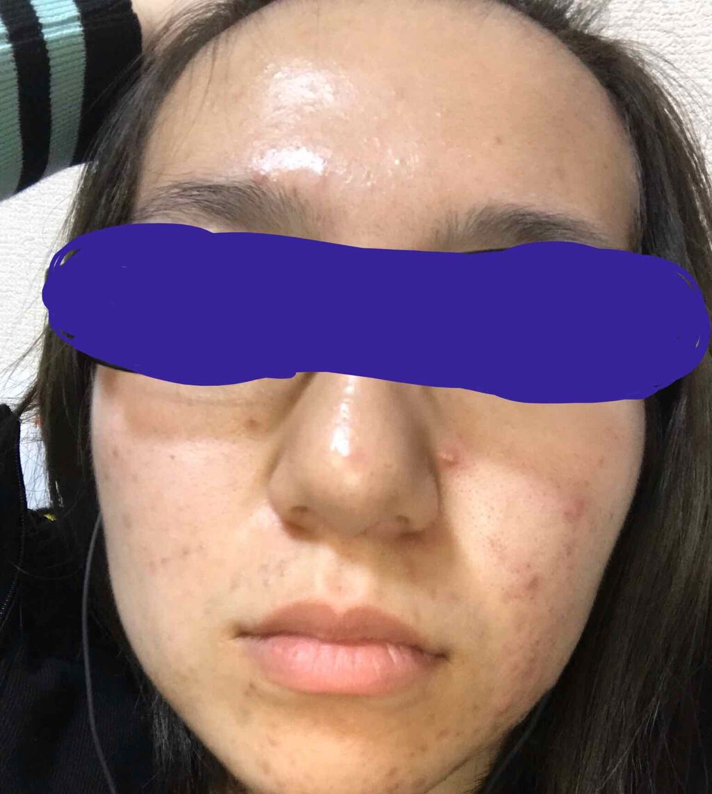 ゼロ毛穴パッド/MEDICUBE/ブースター・導入液を使ったクチコミ（3枚目）