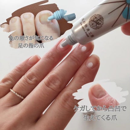 薬用 クリアストロングショット アルファ/北の快適工房/レッグ・フットケアを使ったクチコミ(3枚目)