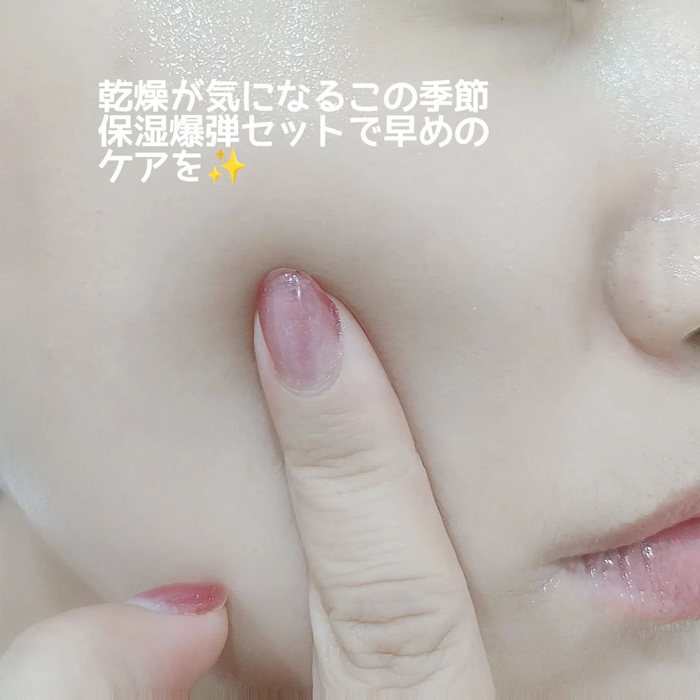 フルフィットプロポリスシナジートナー/COSRX/化粧水を使ったクチコミ(6枚目)