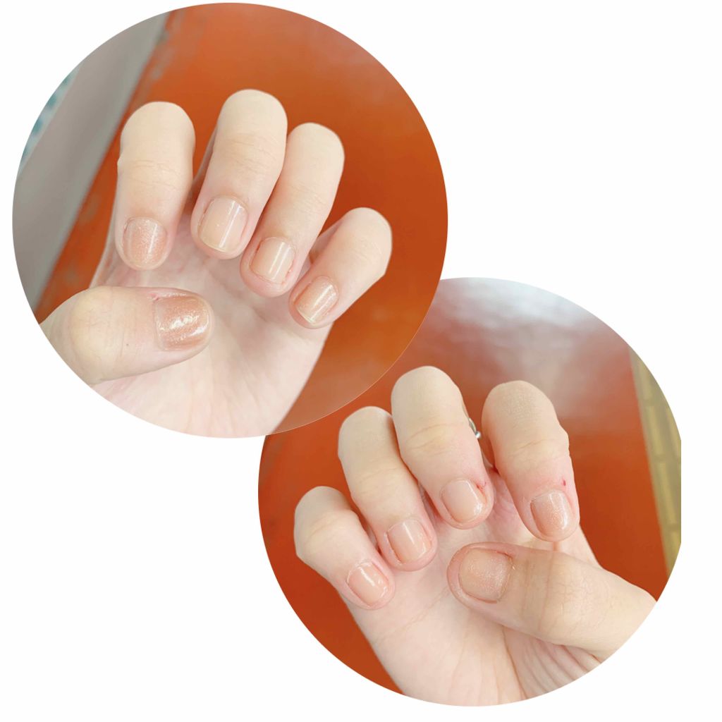 ネイルサポート ピンク/ネイルネイル/ネイルベースコートを使ったクチコミ（2枚目）