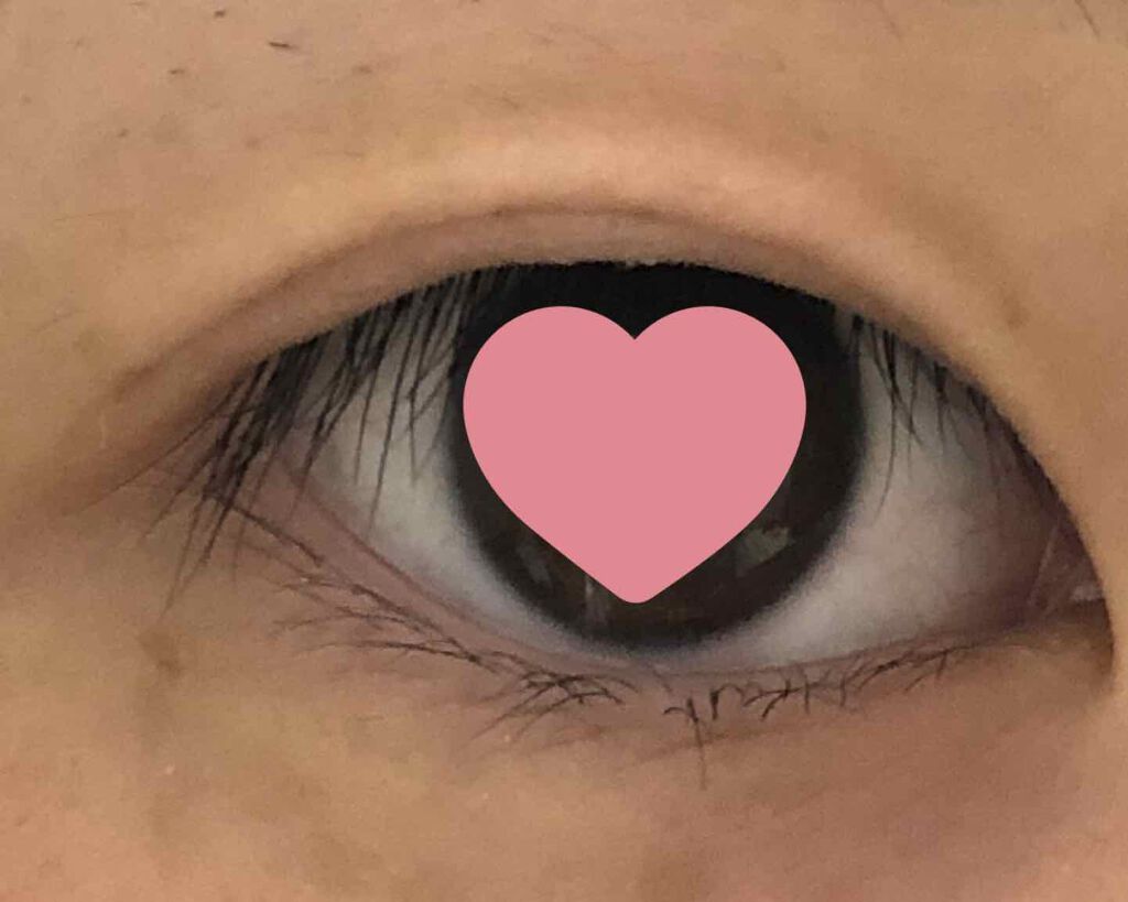 アイビューティー フィクサー WP/アストレア ヴィルゴ/二重まぶた用アイテムを使ったクチコミ（1枚目）