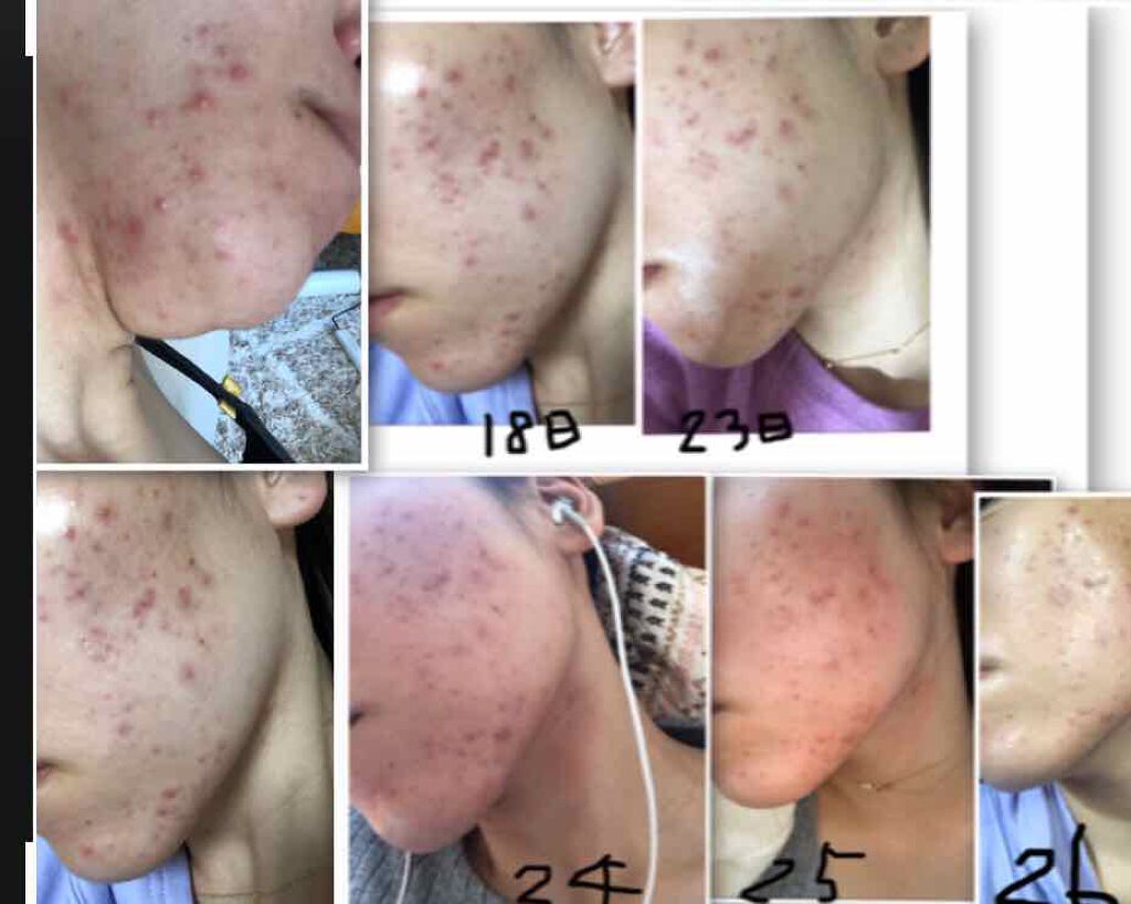 ハトムギ化粧水(ナチュリエ スキンコンディショナー R )/ナチュリエ/化粧水を使ったクチコミ(2枚目)