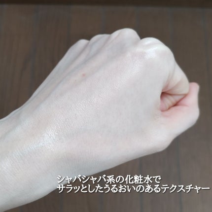 アキュネ 薬用ふきとりローションU/アキュネ/拭き取り化粧水を使ったクチコミ(5枚目)