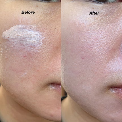 UVイデア XL プロテクショントーンアップ ローズ/ラ ロッシュ ポゼ/日焼け止めクリームを使ったクチコミ(2枚目)