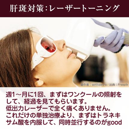 ðððððžãã©ããð¯ on LIPS ãå®ã¯ãã®ã·ãèæããïŒãç§ã®èæå¯Ÿçãã玹ä»ããŸã+*ïŸïœ¡*..ãïŒ4æç®ïŒ