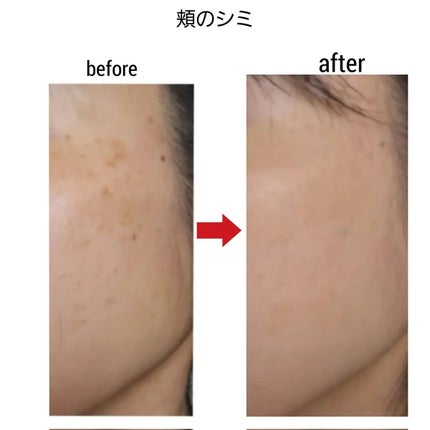 を使ったクチコミ(2枚目)