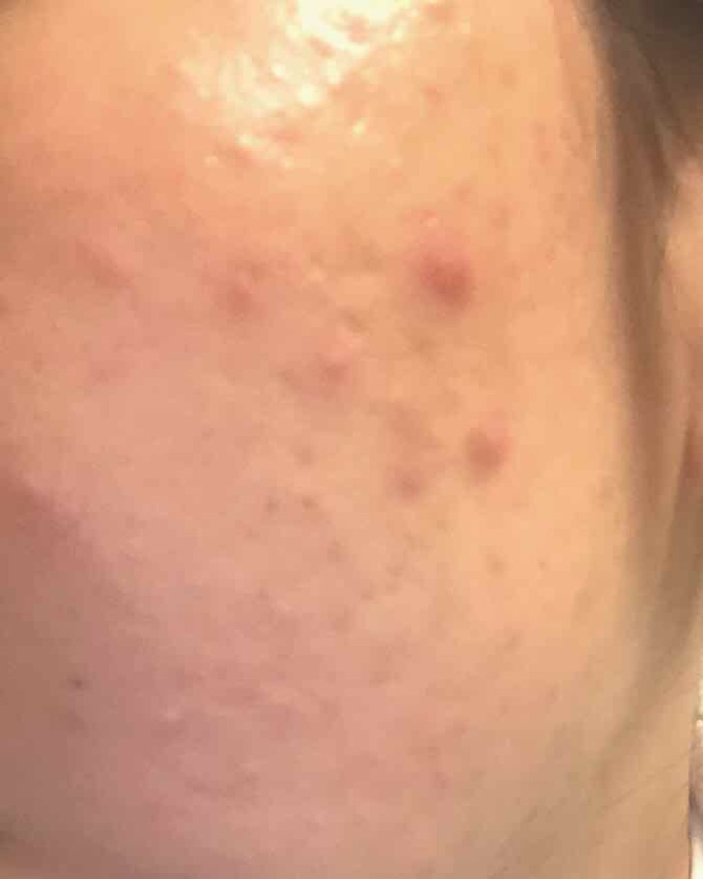 ハトムギ化粧水(ナチュリエ スキンコンディショナー R )/ナチュリエ/化粧水を使ったクチコミ(1枚目)