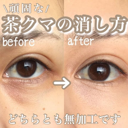 ラディアント タッチ/YVES SAINT LAURENT BEAUTE/リキッドコンシーラーを使ったクチコミ(1枚目)