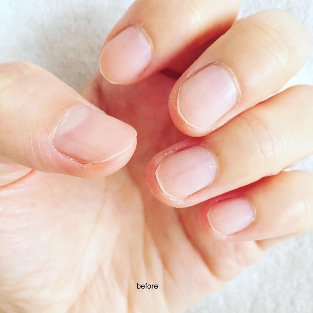 ファイブインワンケアコート/ネイリスト/オールインワンネイルを使ったクチコミ（1枚目）