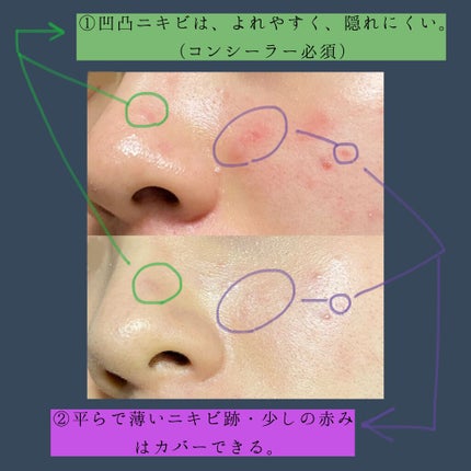 フィットミー リキッドファンデーション R/MAYBELLINE NEW YORK/リキッドファンデーションを使ったクチコミ(5枚目)