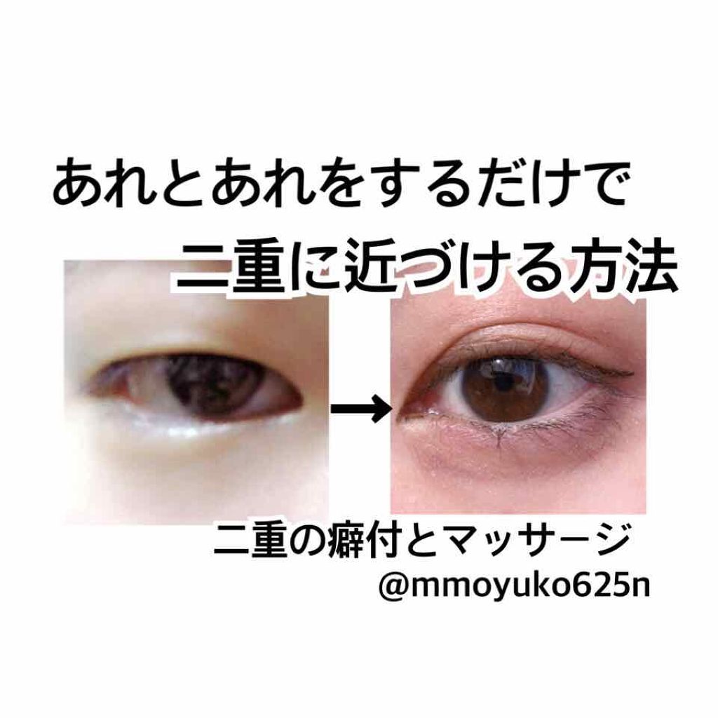 のびーるアイテープ（絆創膏タイプ、レギュラー）/DAISO/二重まぶた用アイテムを使ったクチコミ（1枚目）