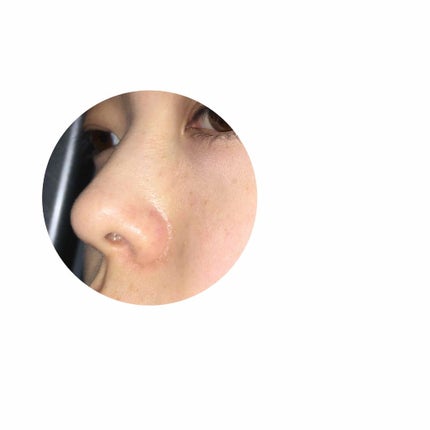 スーパー毛穴ローション/ラボラボ/化粧水を使ったクチコミ(3枚目)