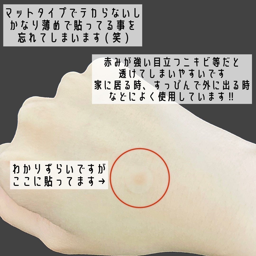 ティーツリーカーミングスポットパッチ/MEDIHEAL/その他スキンケアを使ったクチコミ(4枚目)