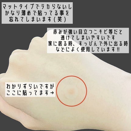 ティーツリーカーミングスポットパッチ/MEDIHEAL/その他スキンケアを使ったクチコミ(4枚目)