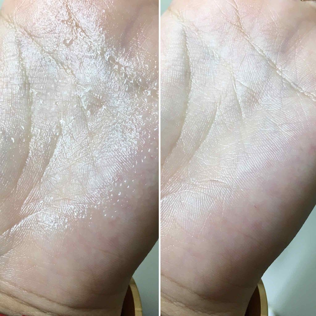 アレルバリア ミスト/d プログラム/ミスト状化粧水を使ったクチコミ(4枚目)