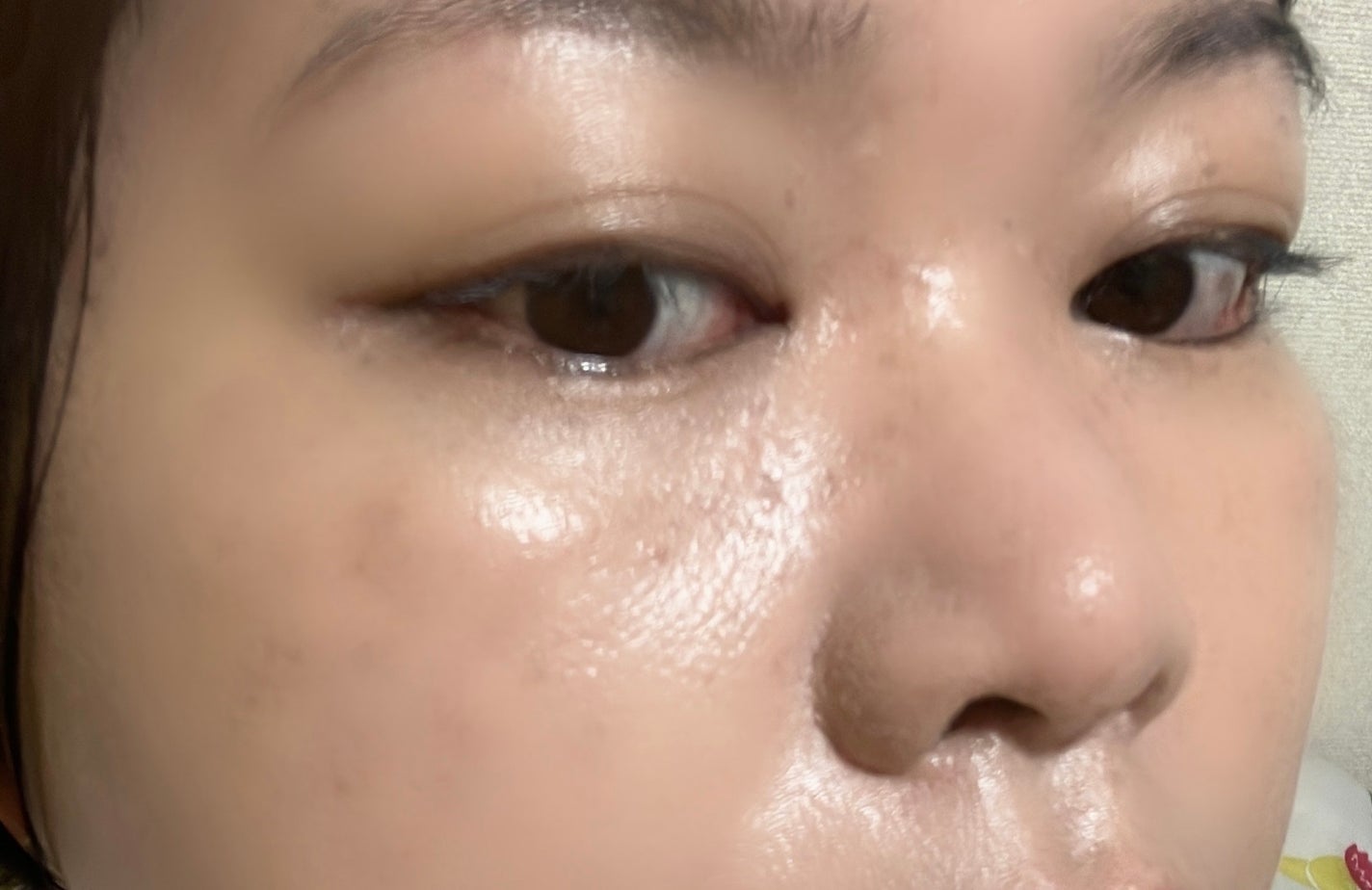 敏感肌用薬用美白化粧水/無印良品/化粧水を使ったクチコミ(1枚目)