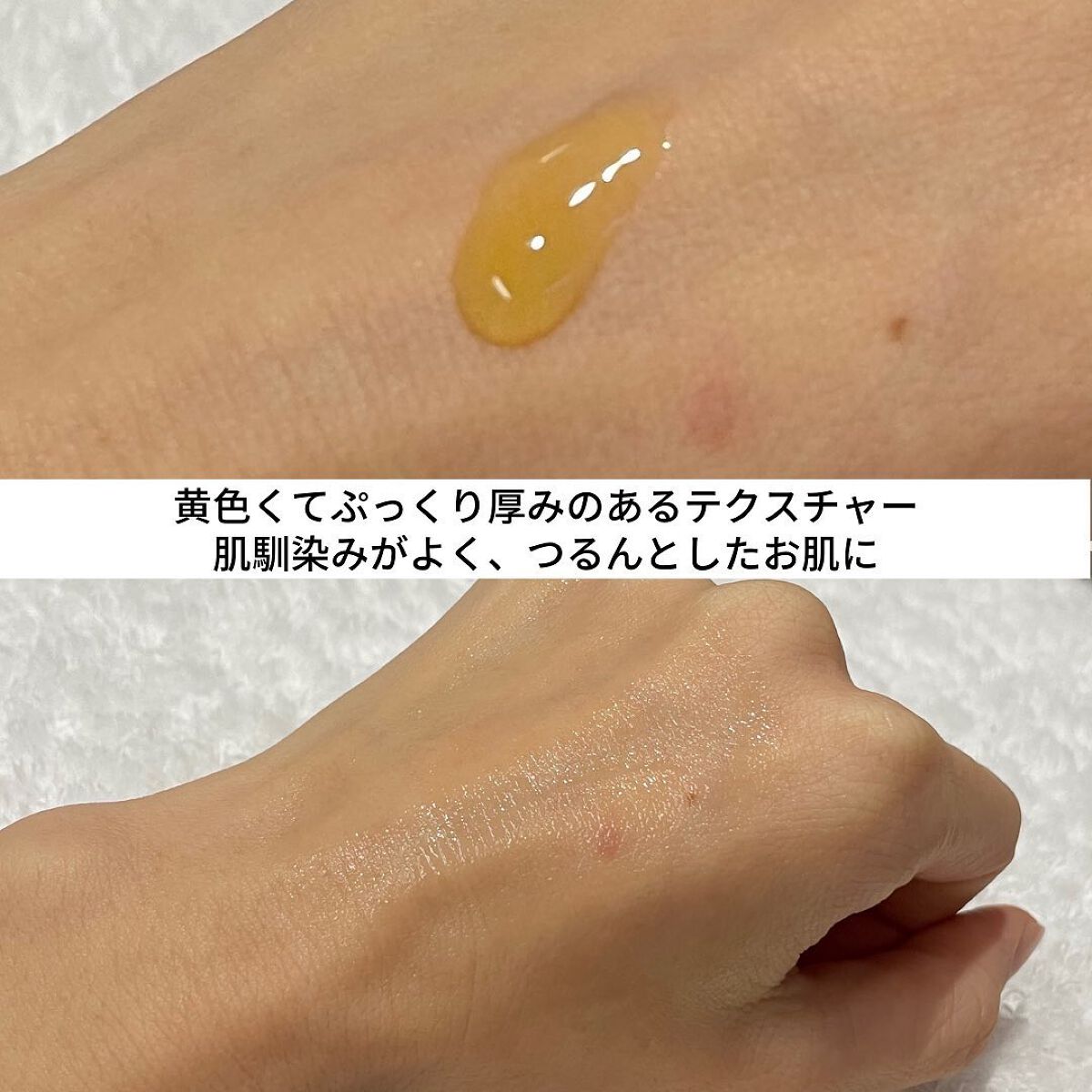 ミシャ ビタシープラス 美容液【日本処方】/MISSHA/美容液を使ったクチコミ(5枚目)