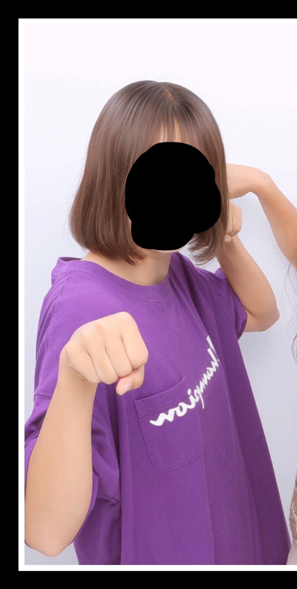 オキシドール(医薬品)/日本薬局方/その他を使ったクチコミ(1枚目)