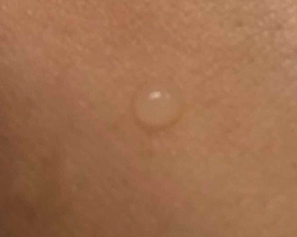 リペア セロム/エステダム/美容液を使ったクチコミ（2枚目）