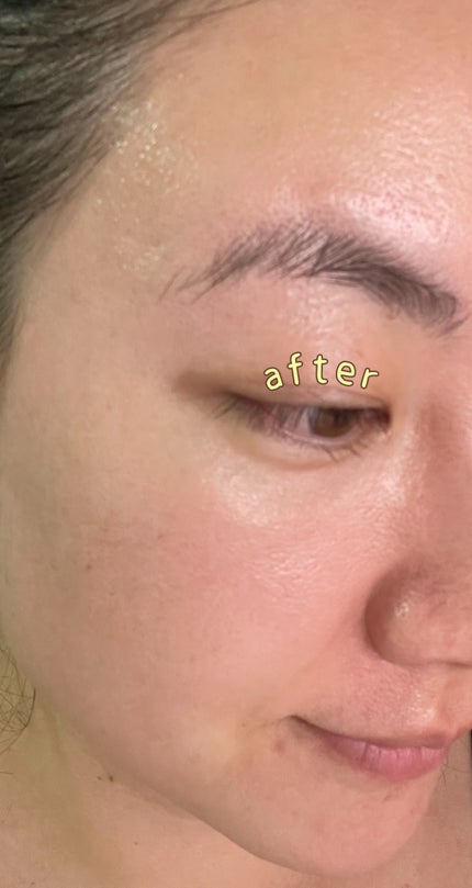 ユース ラディアンス ビタチノール セラム/primera/美容液を使ったクチコミ(1枚目)