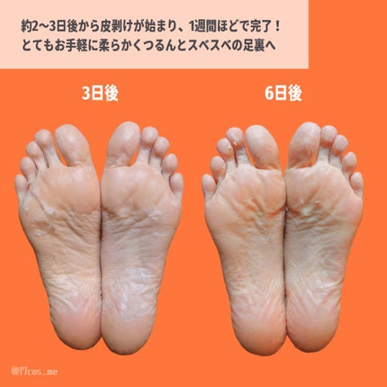 あしやすめ 足裏角質ケアパック/鎌倉ライフ/レッグ・フットケアを使ったクチコミ(3枚目)