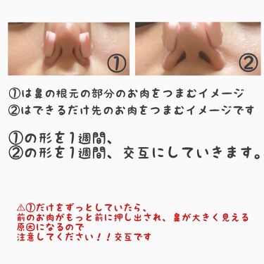 ノーズトレーナー Daisoの口コミ 超優秀 100均で買えるおすすめスキンケアグッズ 鼻をだいぶマシする方法 By 適当さん Lips ノーズトレーナー Daisoの口コミ 超優秀 100均で買えるおすすめスキンケアグッズ 鼻をだいぶマシする方法 By 適当さん Lips