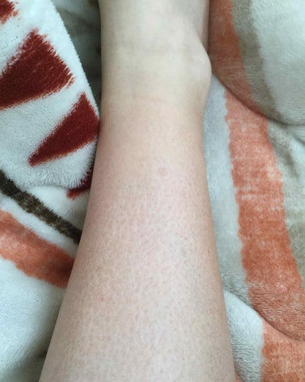 を使ったクチコミ(1枚目)