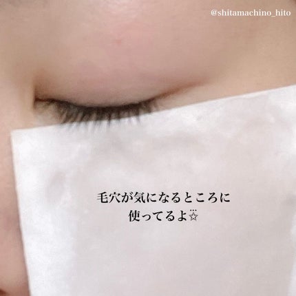 VC100エッセンスローション EX/ドクターシーラボⓇ/化粧水を使ったクチコミ(5枚目)