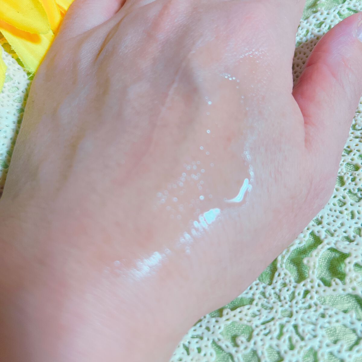 バイオイル/バイオイル/フェイスオイルを使ったクチコミ(3枚目)