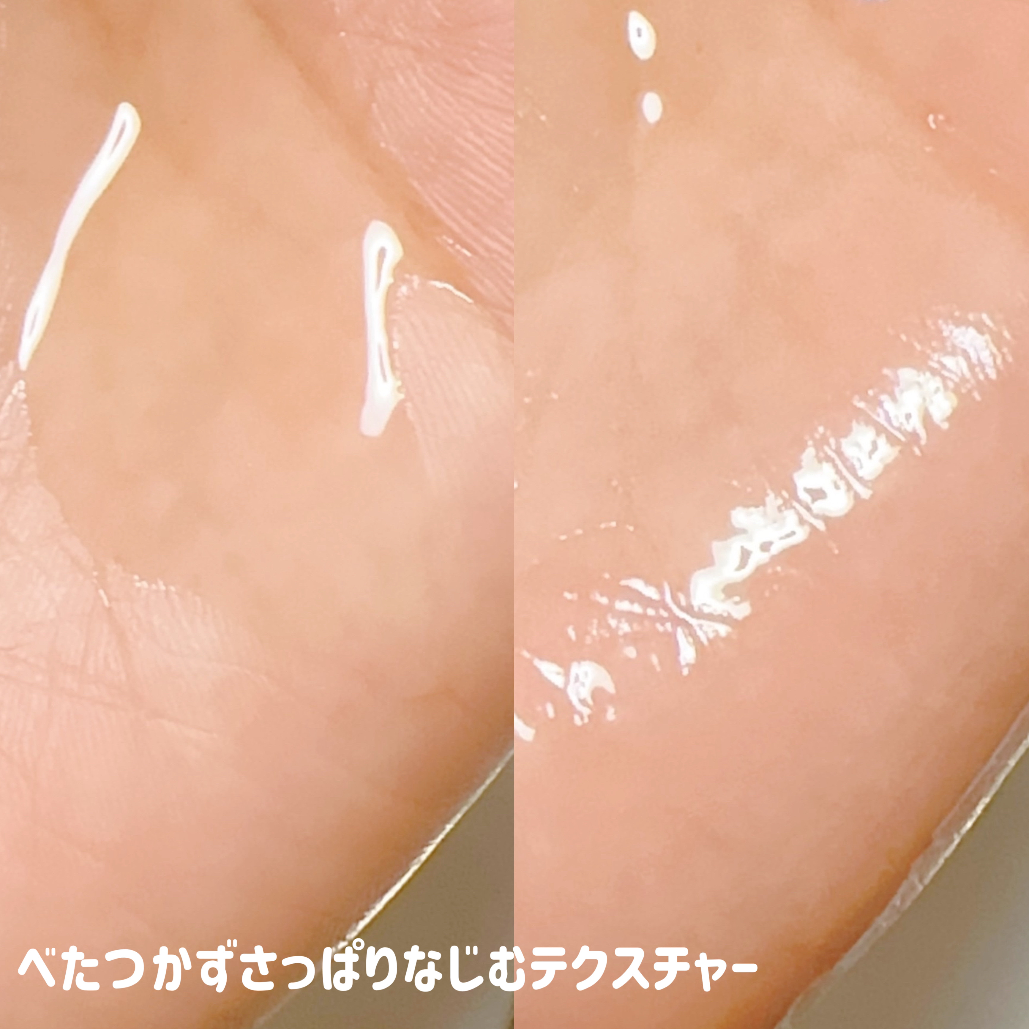 AGE-RビタＣプロアンプル/MEDICUBE/美容液を使ったクチコミ（3枚目）